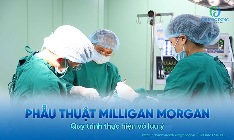 Phẫu thuật milligan morgan: Quy trình thực hiện và lưu ý