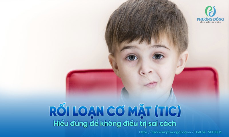Rối loạn cơ mặt (Tic): Hiểu đúng để không điều trị sai cách