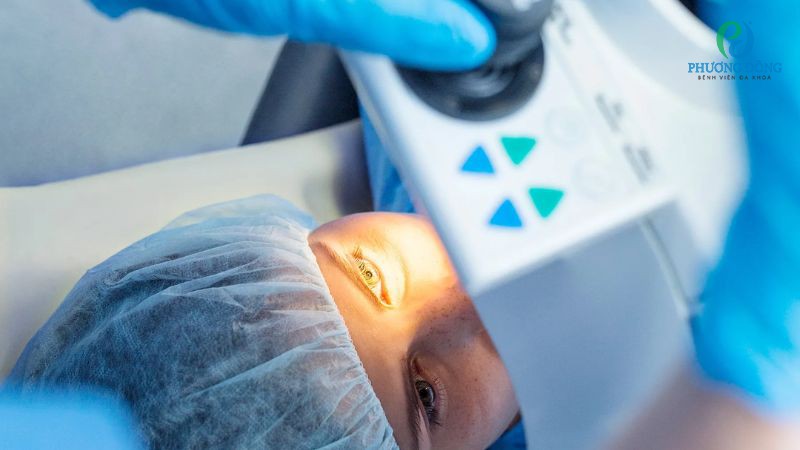 Quy trình can thiệp ngoại khoa loại bỏ hột sạn vôi ở mắt