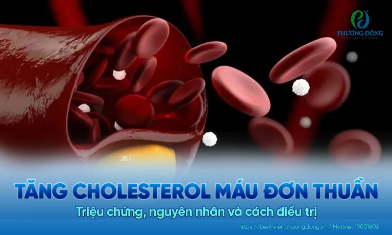 Tăng cholesterol máu đơn thuần là gì? Triệu chứng, nguyên nhân và cách điều trị