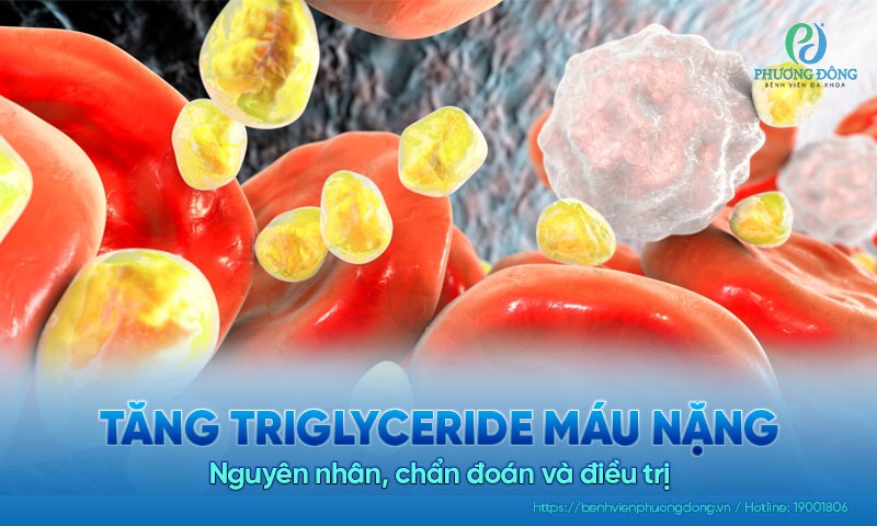 Tăng triglyceride máu nặng: Nguyên nhân, chẩn đoán và điều trị