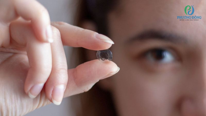 Điều chỉnh thị lực bằng cách dùng kính áp tròng Ortho-K