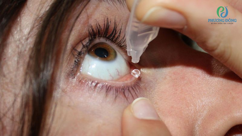 Các bước sơ cứu mắt khi bị bụi bẩn hoặc mảnh vụn bay vào mắt