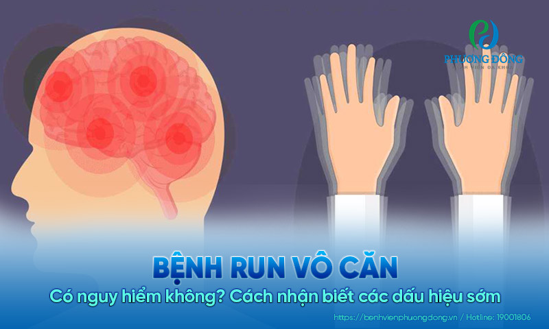 Run vô căn có nguy hiểm không? Cách nhận biết các dấu hiệu sớm 