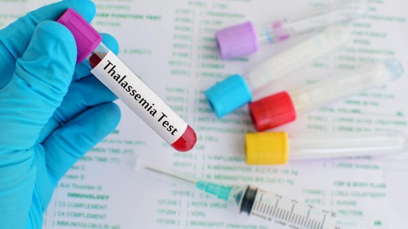 Bệnh thiếu máu hồng cầu nhỏ Thalassemia 