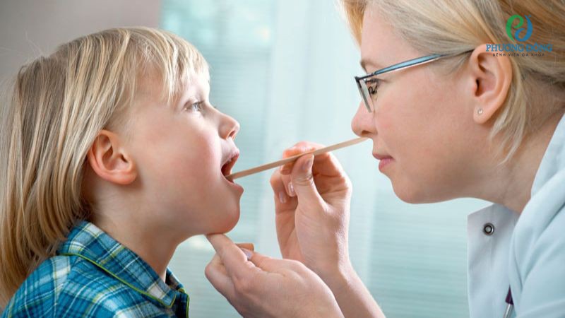 Một số lưu ý khi hạ sốt cho trẻ bị viêm amidan