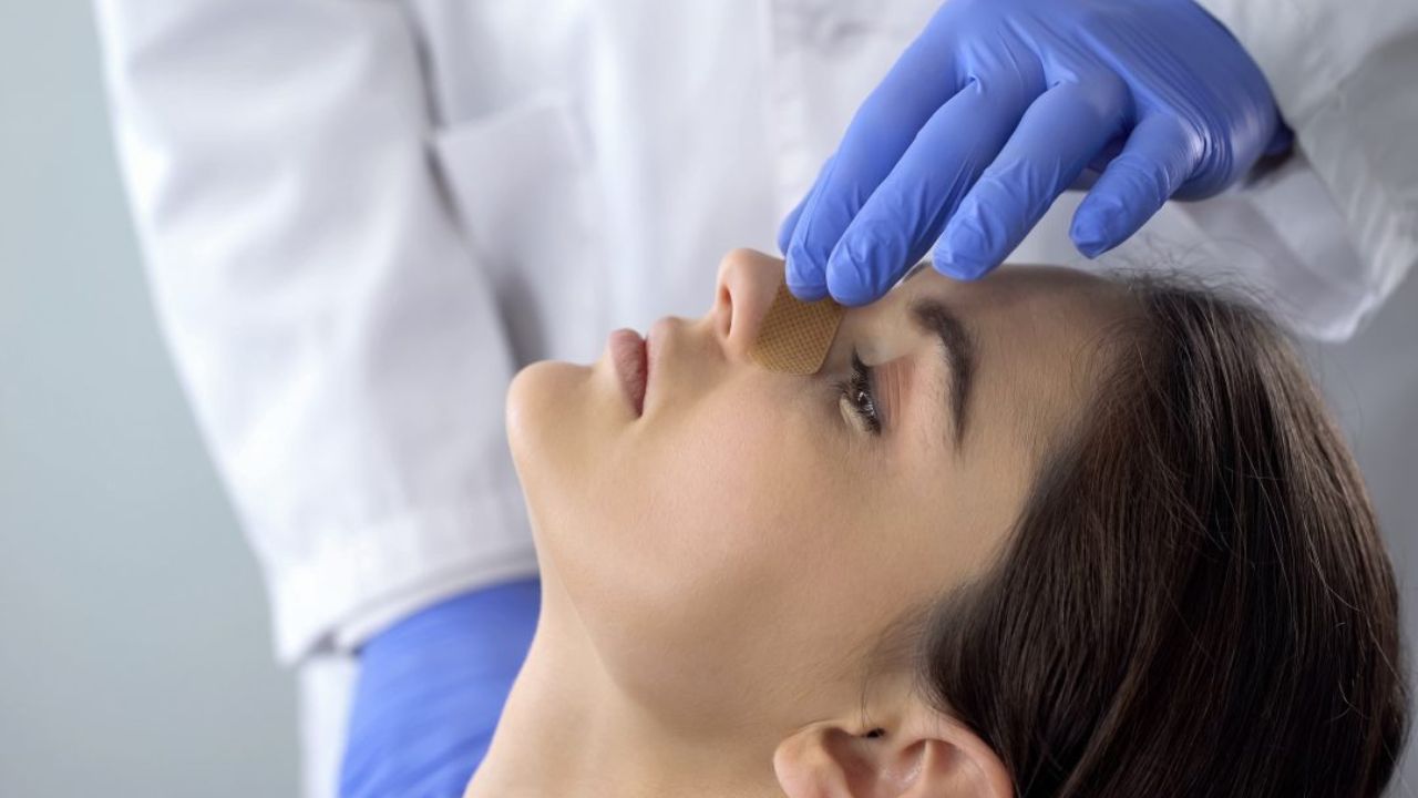 Bạn nên điều trị gãy xương sống mũi càng sớm cáng tốt