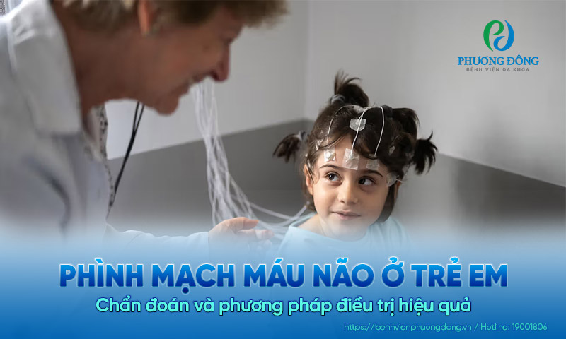 Phình mạch máu não ở trẻ em: Chẩn đoán và phương pháp điều trị hiệu quả