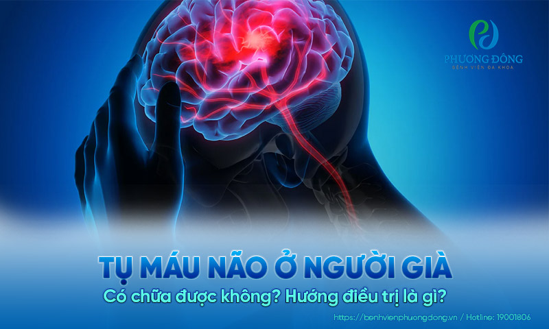 Tụ máu não ở người già có chữa được không? Hướng điều trị là gì?