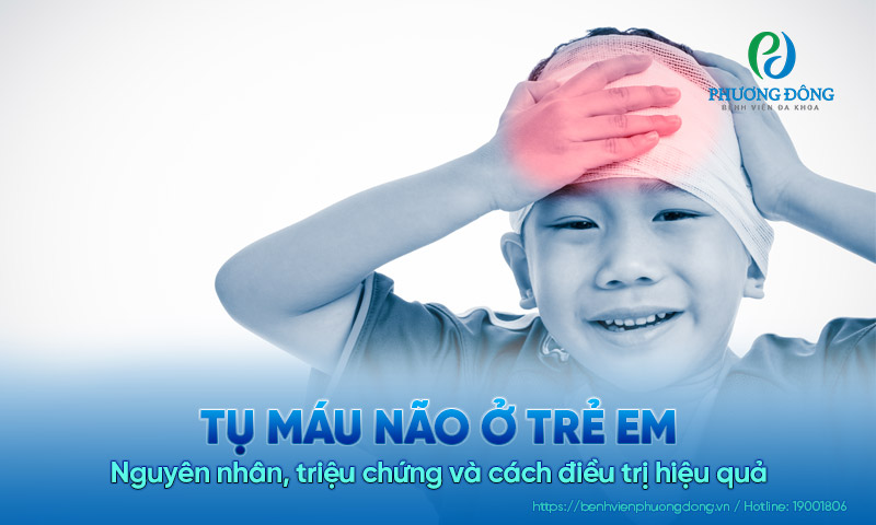 Tụ máu não ở trẻ em: Nguyên nhân, triệu chứng và cách điều trị hiệu quả