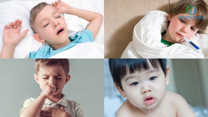 Nhóm triệu chứng sau nạo VA kèm theo sổ mũi