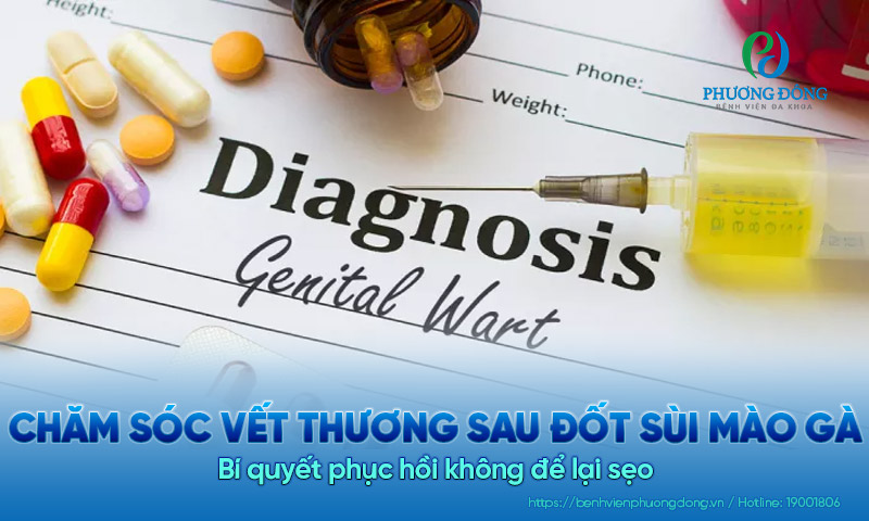 Chăm sóc vết thương sau đốt sùi mào gà: Bí quyết phục hồi không để lại sẹo?