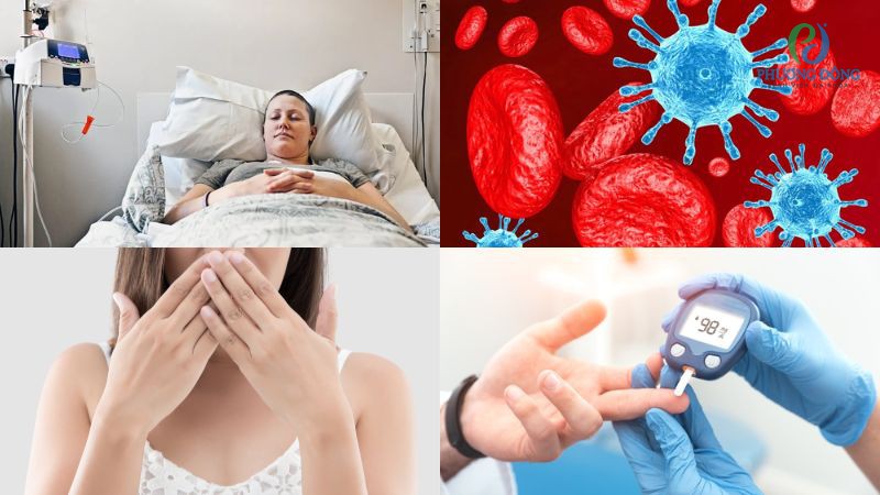 Nhóm nguyên nhân tạo điều kiện cho nấm Candida phát triển
