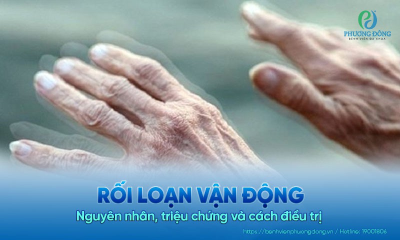 Rối loạn vận động: Nguyên nhân, triệu chứng và cách điều trị 