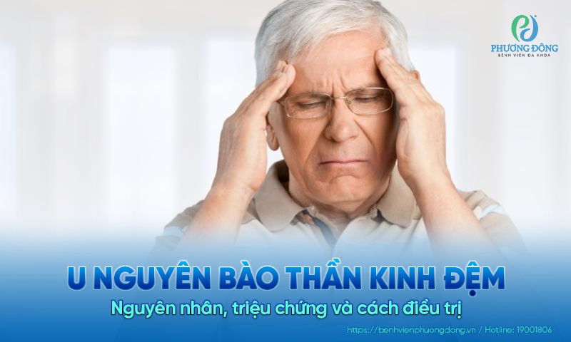 U nguyên bào thần kinh đệm: Nguyên nhân, triệu chứng và cách điều trị
