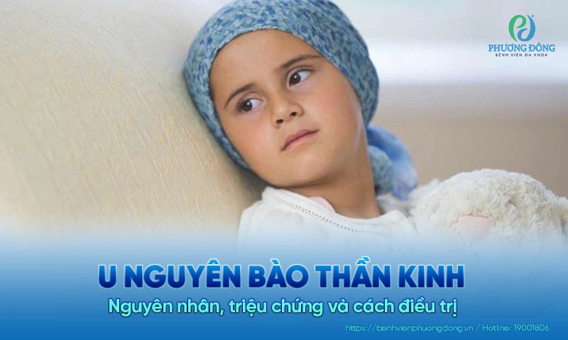 U nguyên bào thần kinh: Nguyên nhân, triệu chứng và cách điều trị