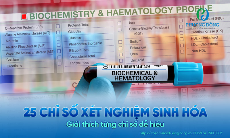 25 chỉ số xét nghiệm sinh hóa là gì? Giải thích từng chỉ số dễ hiểu