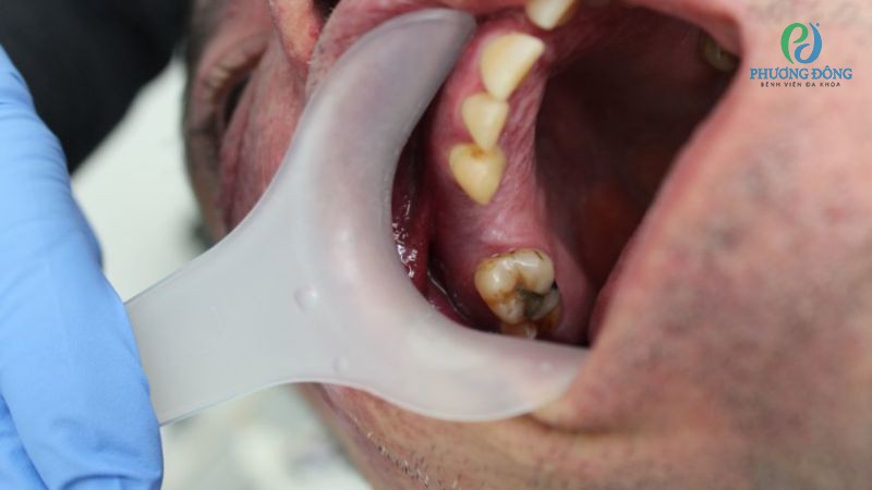 Nhờ công nghệ tiên tiến mà có thể dễ dàng chẩn đoán bệnh bướu lưỡi