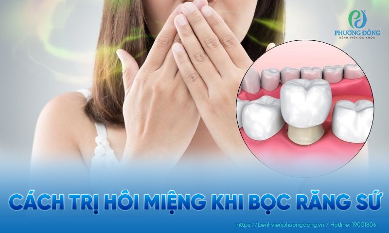 Cách trị hôi miệng khi bọc răng sứ theo gợi ý chuyên gia