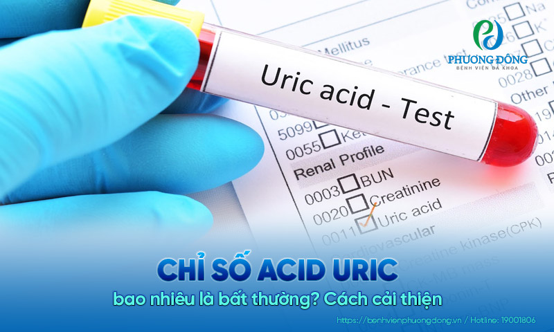 Chỉ số acid uric bao nhiêu là bất thường? Cách cải thiện
