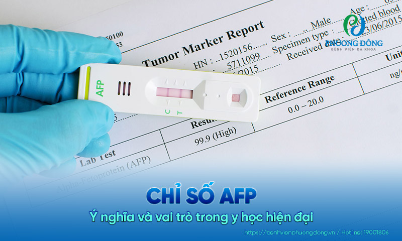 Chỉ số AFP là gì? Ý nghĩa và vai trò trong y học hiện đại