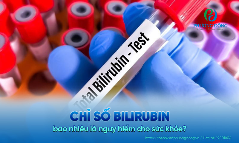 Chỉ số bilirubin bao nhiêu là nguy hiểm cho sức khỏe?