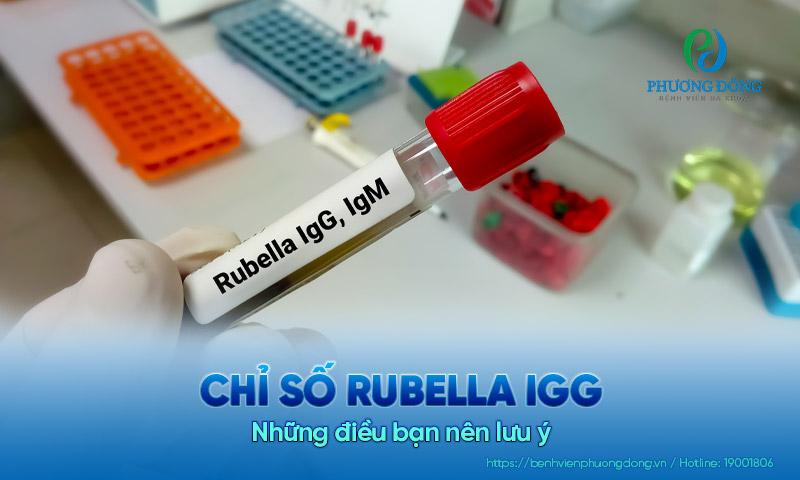 Chỉ số Rubella IgG tăng cao: Những điều bạn nên lưu ý