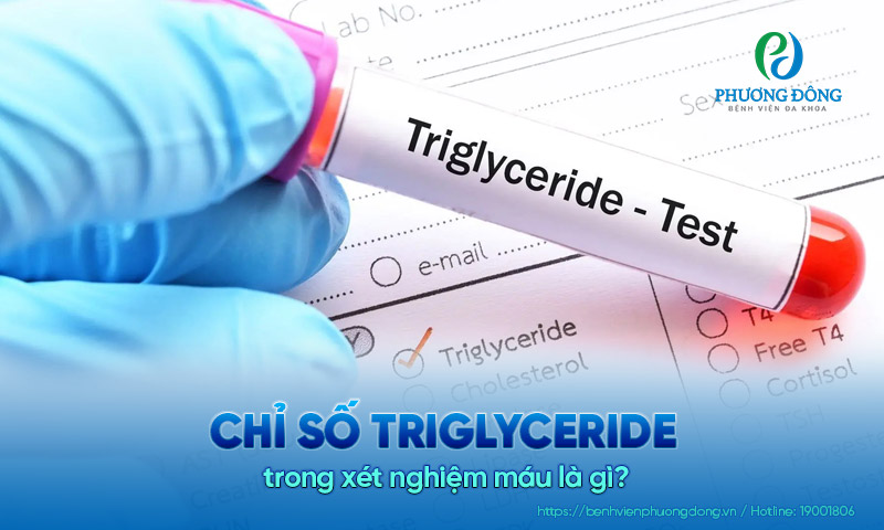 Chỉ số Triglyceride trong xét nghiệm máu là gì? Cùng tìm hiểu ngay