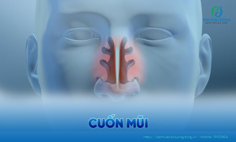 Cuốn mũi: Chức năng và nhóm bệnh lý thường gặp
