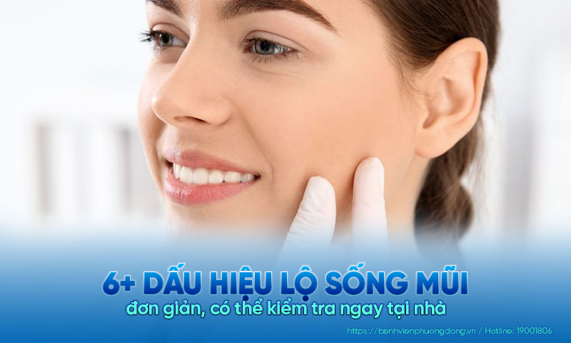 6+ Dấu hiệu lộ sống mũi đơn giản, có thể kiểm tra ngay tại nh
