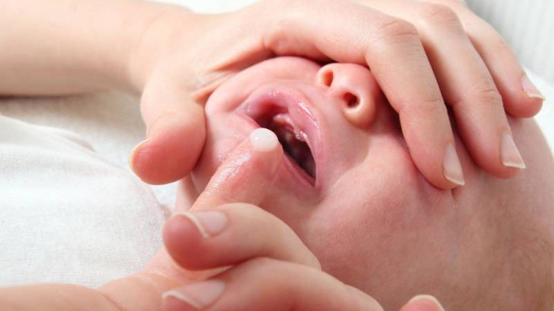 Cha mẹ nên bôi dùng thuốc chống nấm cho bé đúng theo chỉ định của bác sĩ