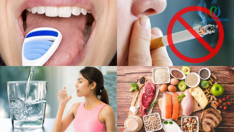 Biện pháp phòng tránh lưỡi chuyển lông màu đen