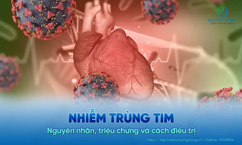 Nhiễm trùng tim: Nguyên nhân, triệu chứng và cách điều trị