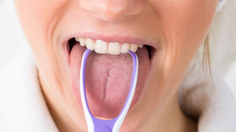 Cạo lưỡi quá nhiều có thể khiến bạn cảm thấy khó chịu ở lưỡi