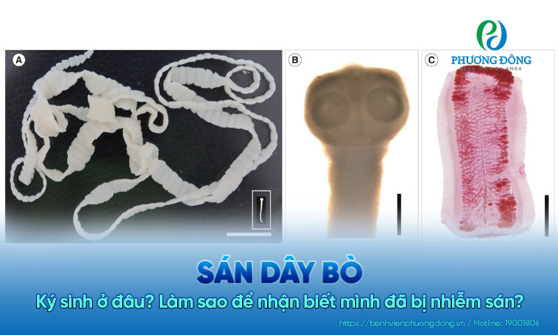 Sán dây bò ký sinh ở đâu? Làm sao để nhận biết mình đã bị nhiễm sán?