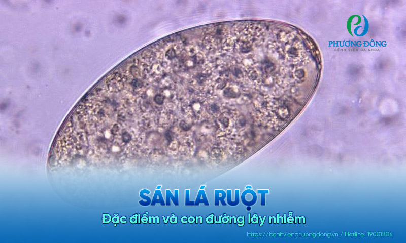Sán lá ruột có mấy loại? Đặc điểm và con đường lây nhiễm