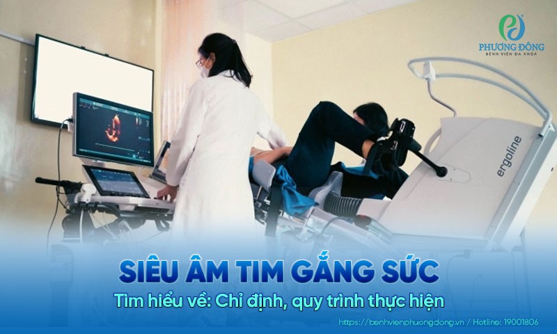 Tìm hiểu về siêu âm tim gắng sức: Chỉ định và quy trình 