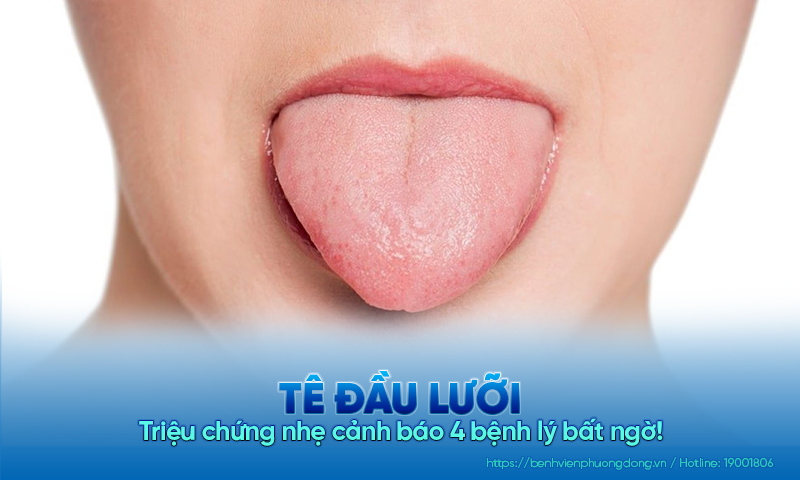 Tê đầu lưỡi - Triệu chứng nhẹ cảnh báo 4 bệnh lý bất ngờ!