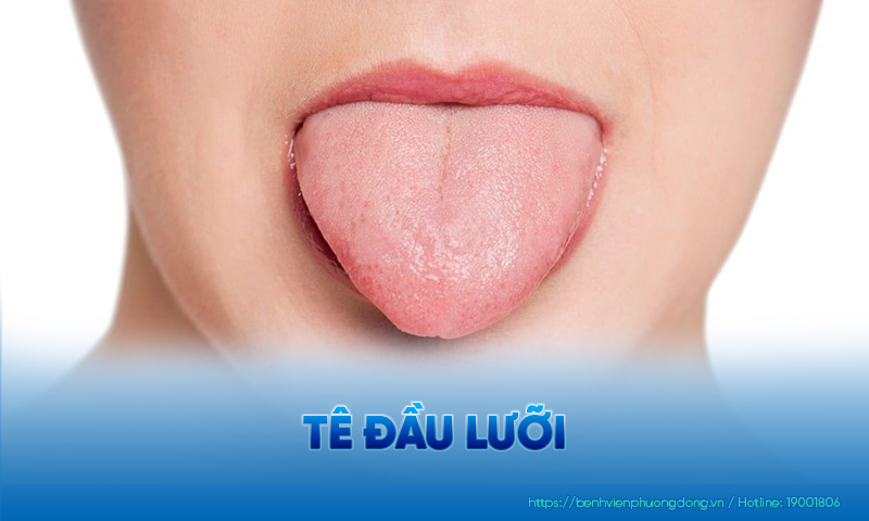 Đầu lưỡi bị tê thường đi kèm với các dấu hiệu khác