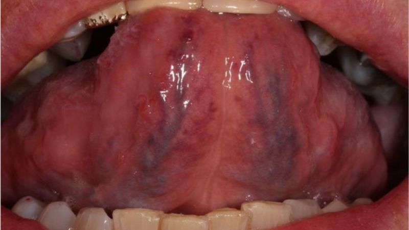 Các loại vi khuẩn có thể là nhân tố thúc đẩy sinh ra các biểu hiện bất thường