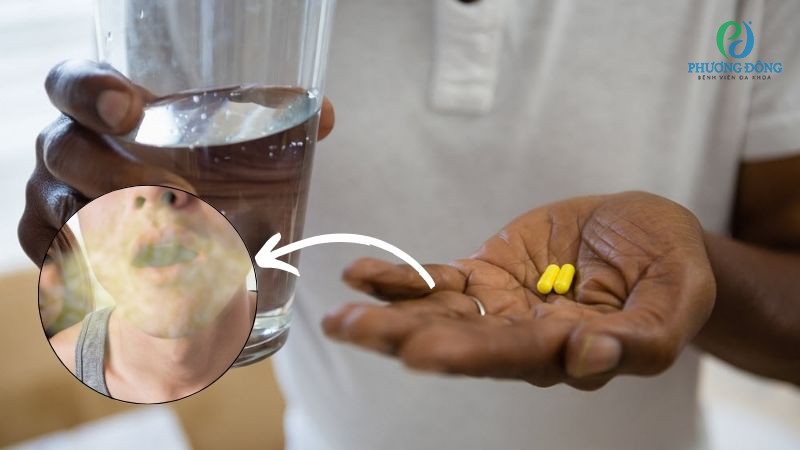 Mục đích sử dụng thuốc trị hôi miệng từ dạ dày