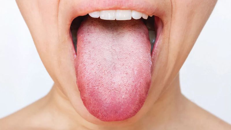 Lưỡi là cơ quan mềm, được liên kết từ 17 nhóm cơ và khoảng 10.000 nụ vị giác khác nhau