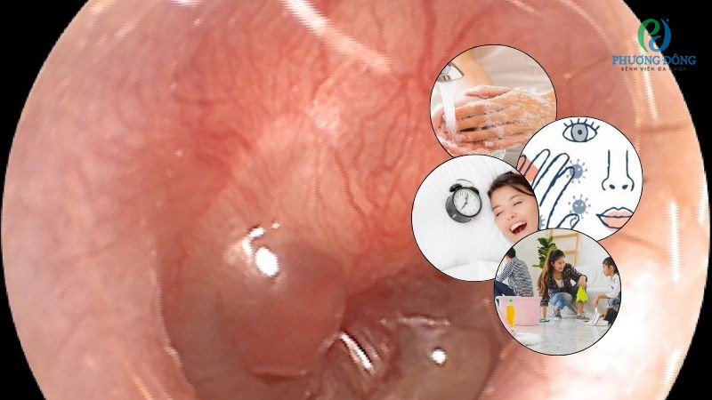Chủ động tránh xa các yếu tố nguy cơ hình trạng bọng nước trong màng nhĩ
