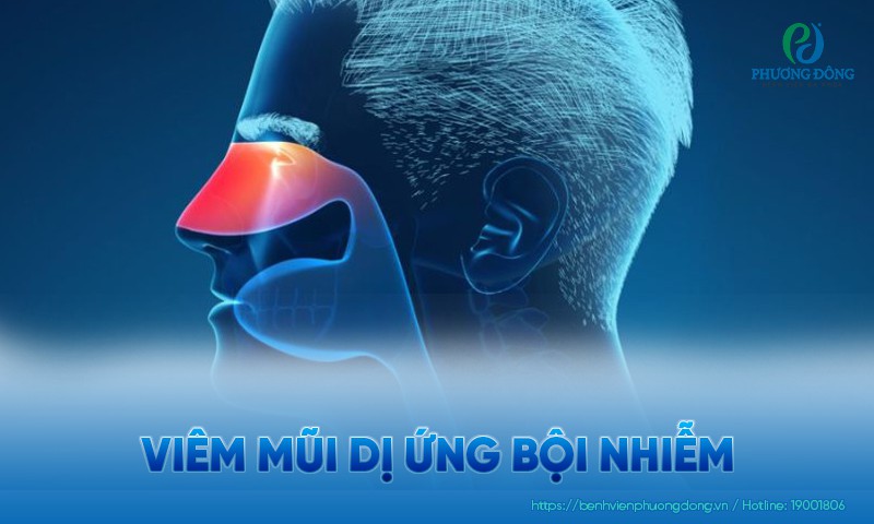 Viêm mũi dị ứng bội nhiễm: Triệu chứng, nguyên nhân và điều trị