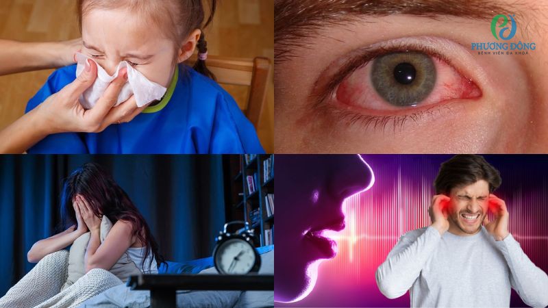 Triệu chứng bà bầu bị viêm mũi dị ứng
