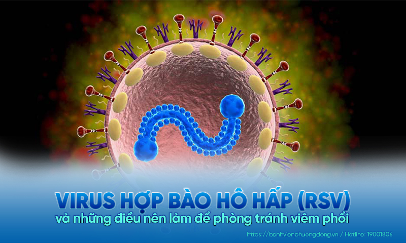Virus hợp bào hô hấp (RSV) và những điều nên làm để phòng tránh viêm phổi