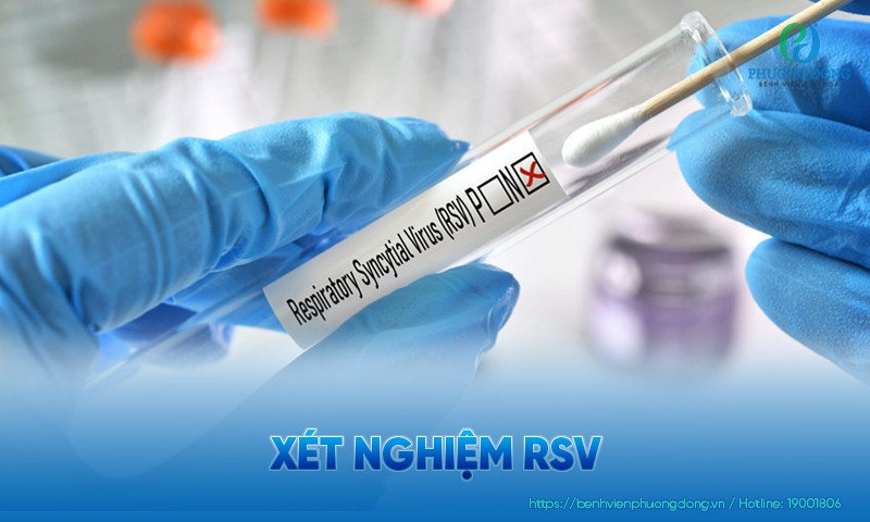 Xét nghiệm RSV: Các phương pháp và ý nghĩa của việc xét nghiệm