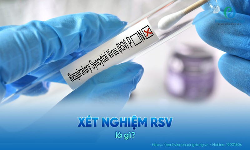 Xét nghiệm RSV là phương pháp phát hiện sự hiện diện của virus RSV trong cơ thể