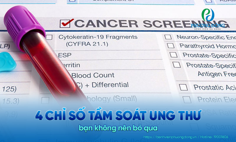 4 chỉ số tầm soát ung thư quan trọng nhất bạn không nên bỏ qua