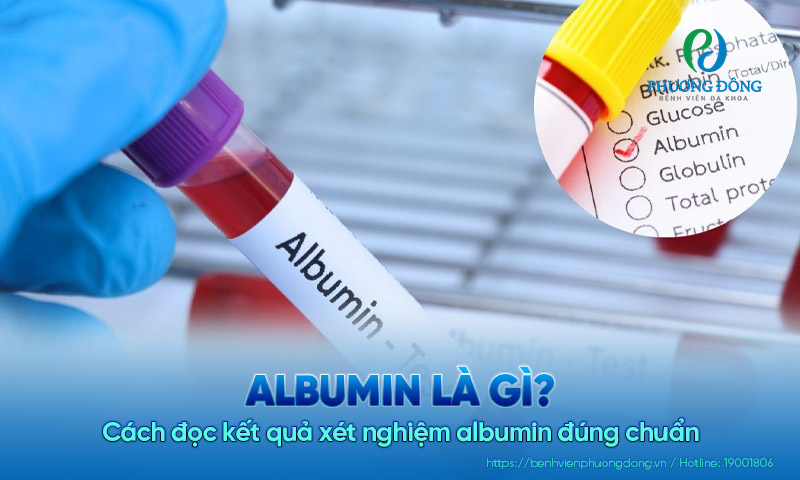 Albumin là gì? Cách đọc kết quả xét nghiệm albumin đúng chuẩn